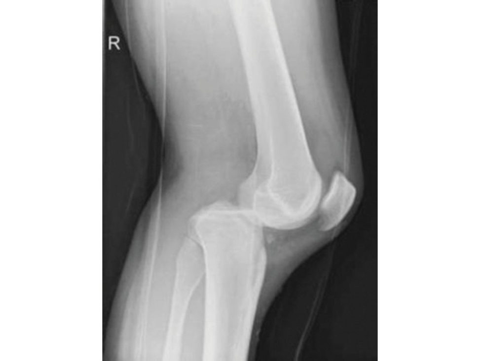 Figure 10.11