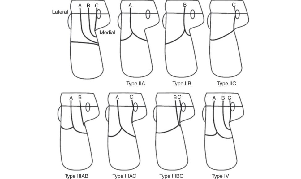 Figure 11.4c