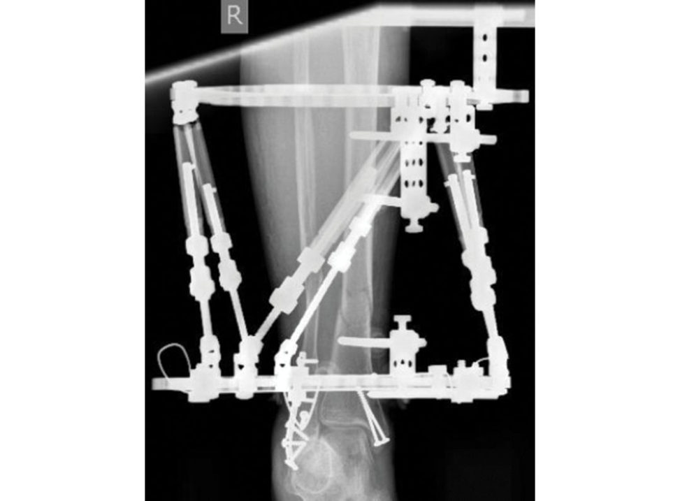 Figure 11.8e