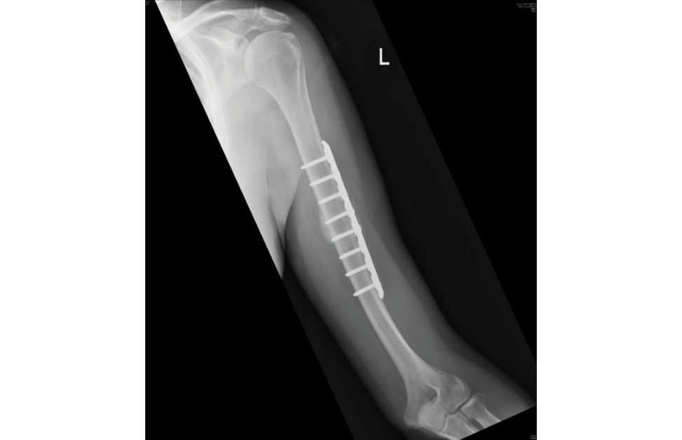 Figure 12.6c