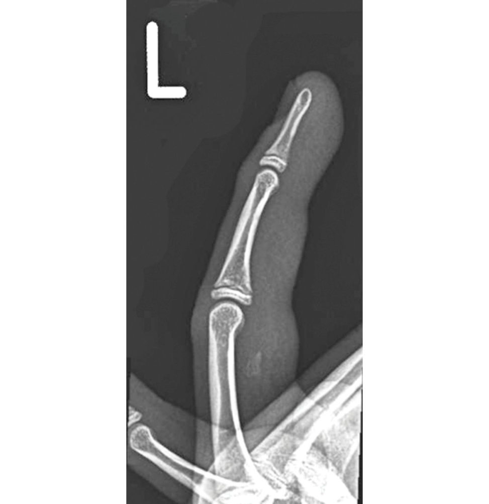 Figure 13.2