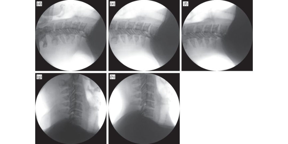 Figure 15.1d