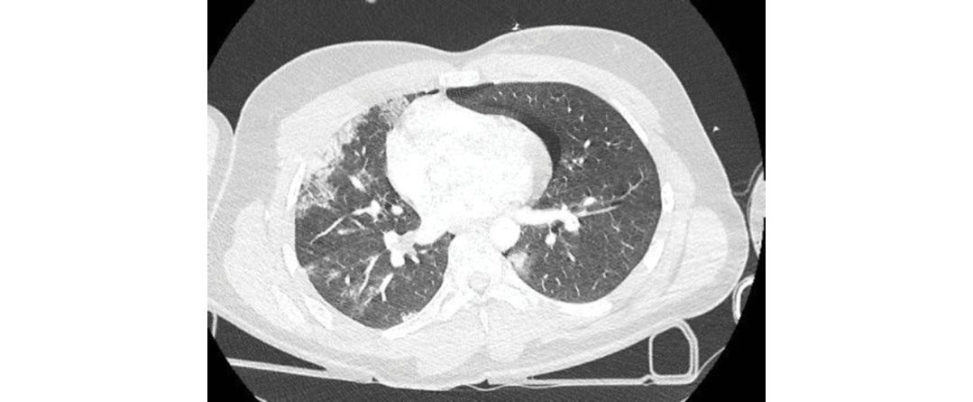 Figure 16.8a