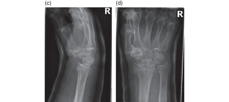 Figure 17.1c