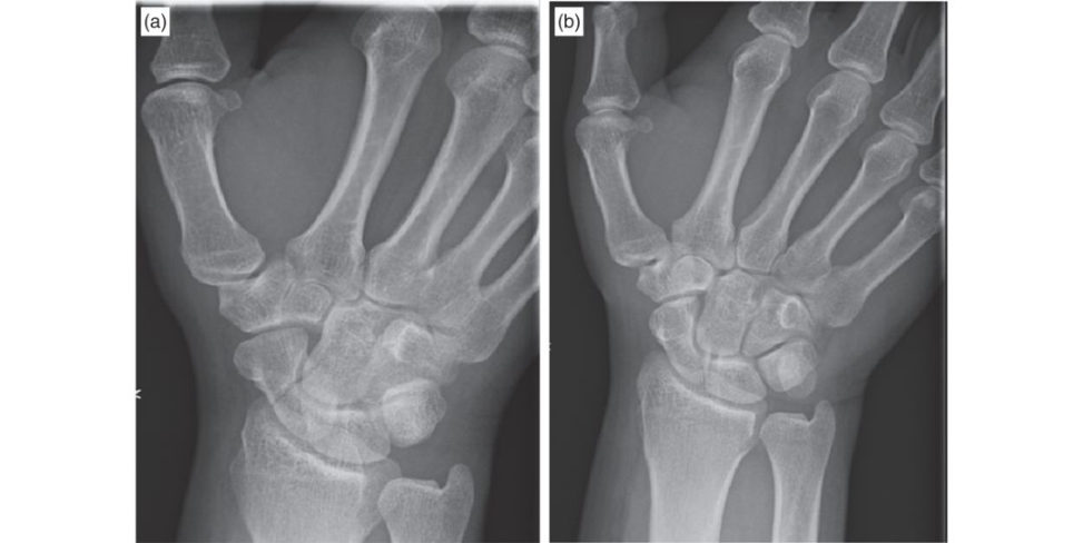 Figure 17.4a