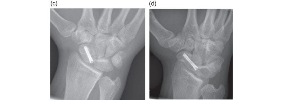Figure 17.5c