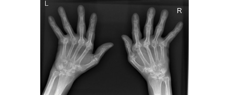 Figure 17.6