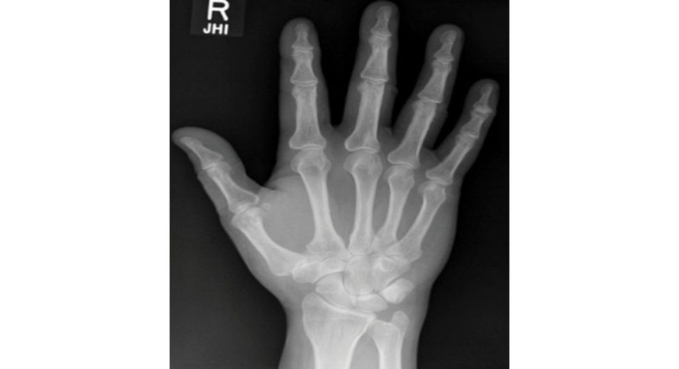 Figure 17.7a