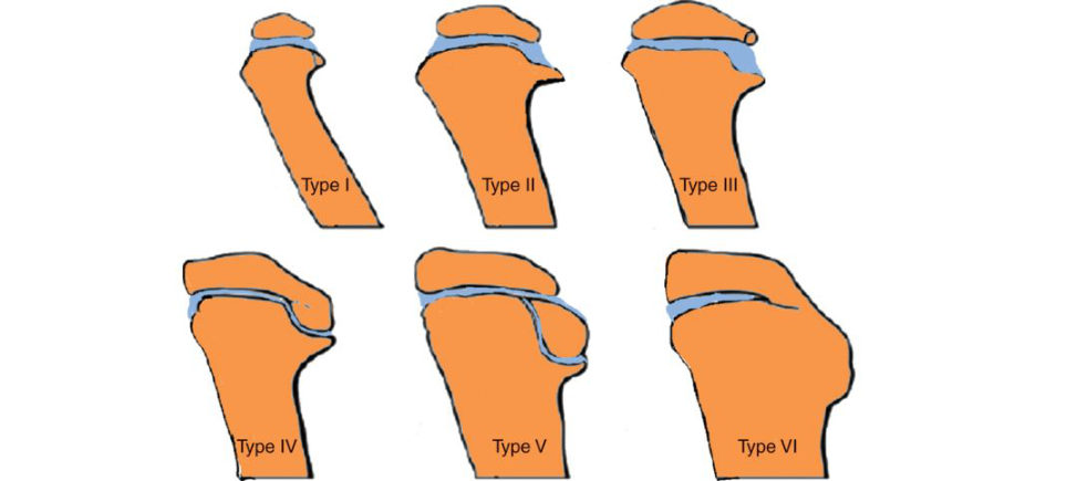 Figure 18.34
