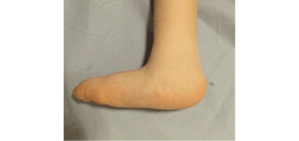 Figure 18.36