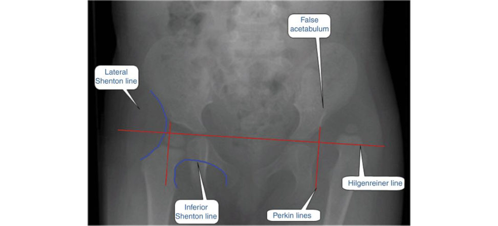 Figure 18.53