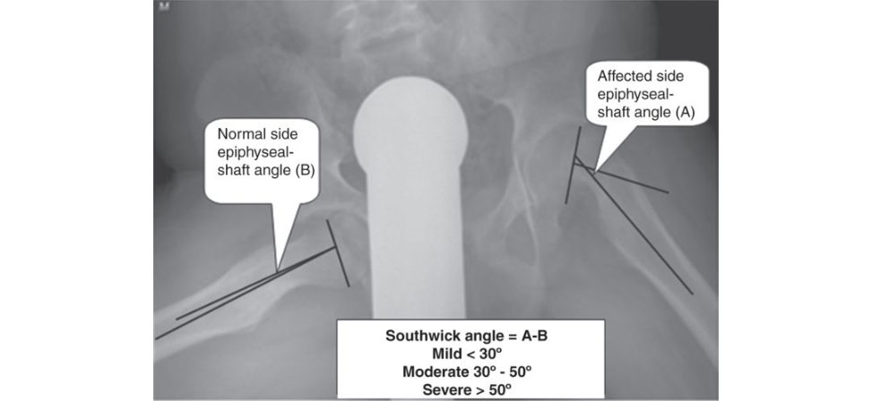 Figure 18.4