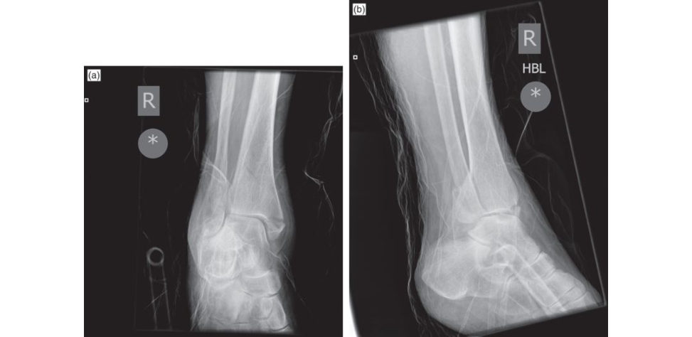 Figure 19.5