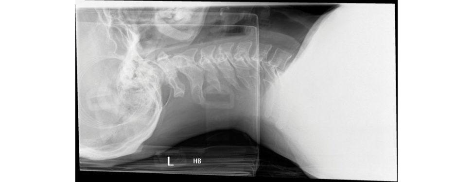 Figure 19.6a