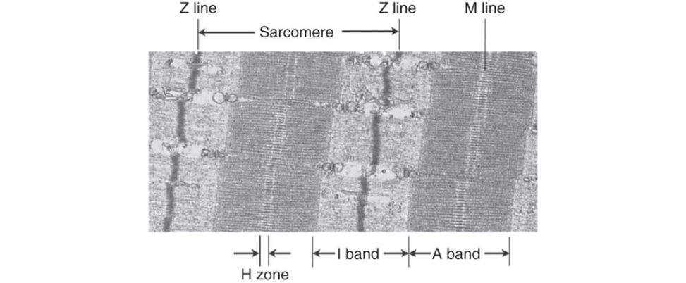 Figure 20.42