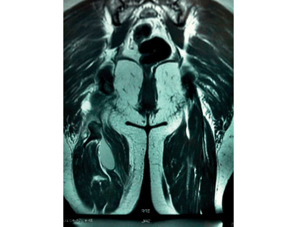 Figure 20.64