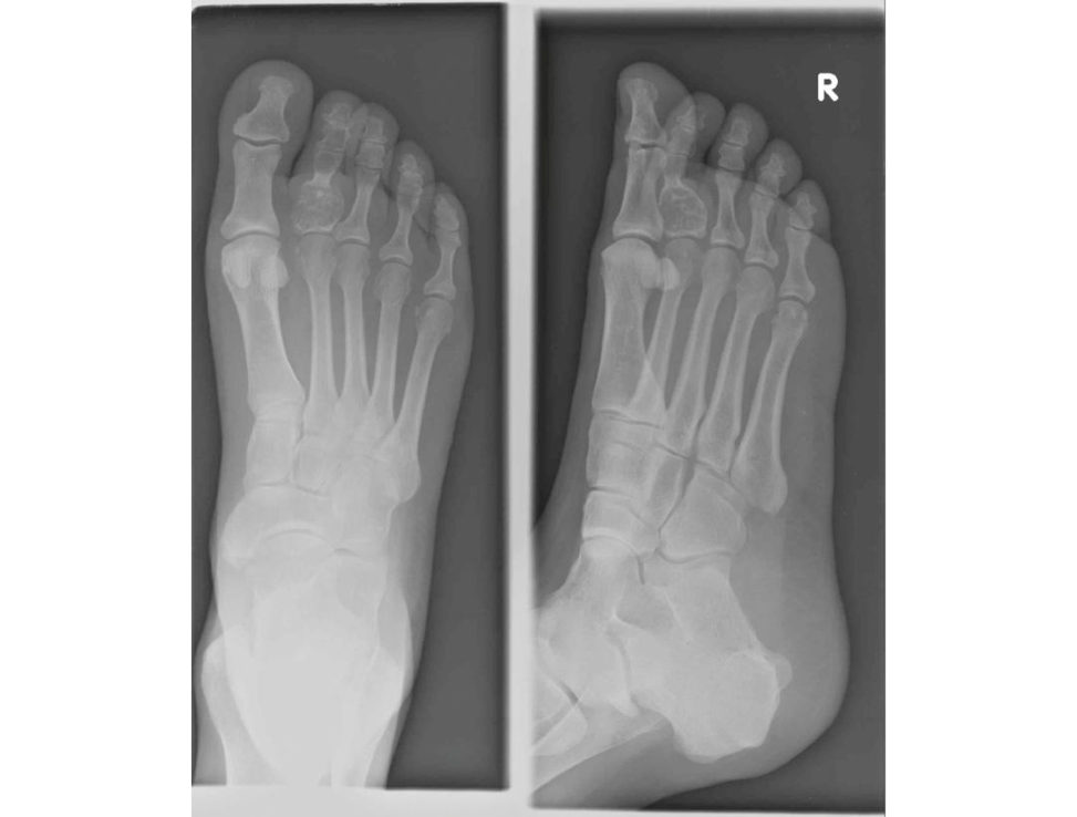 Figure 24.2