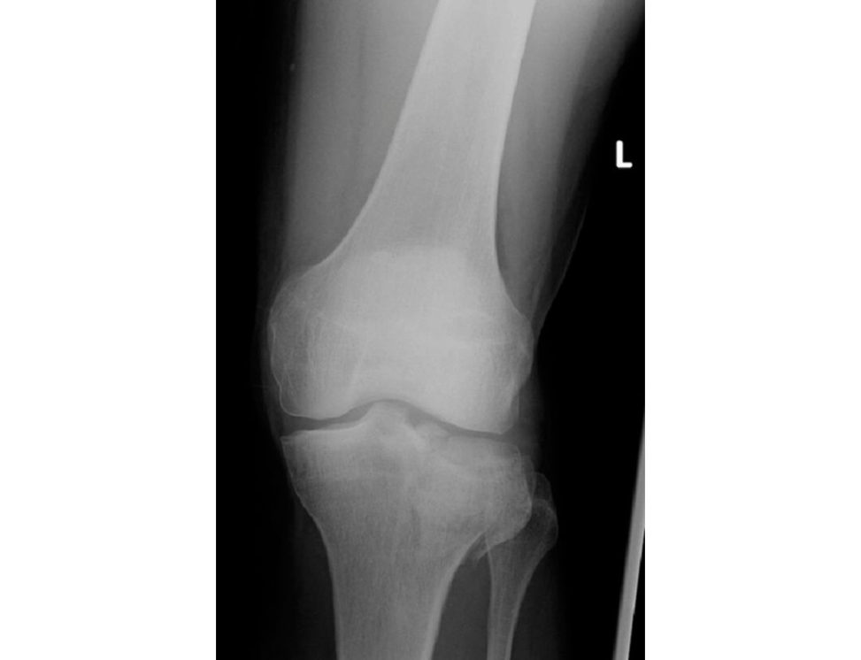 Figure 25.6a