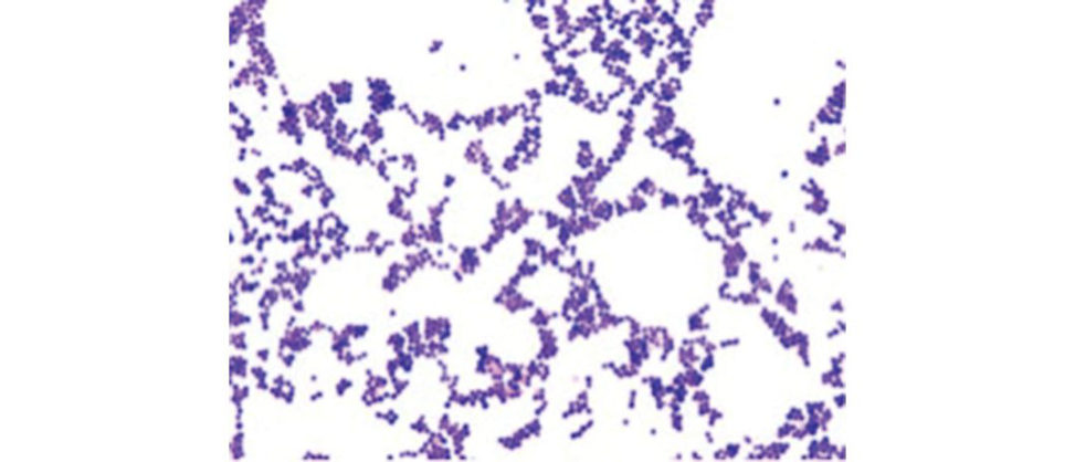 Figure 29.3