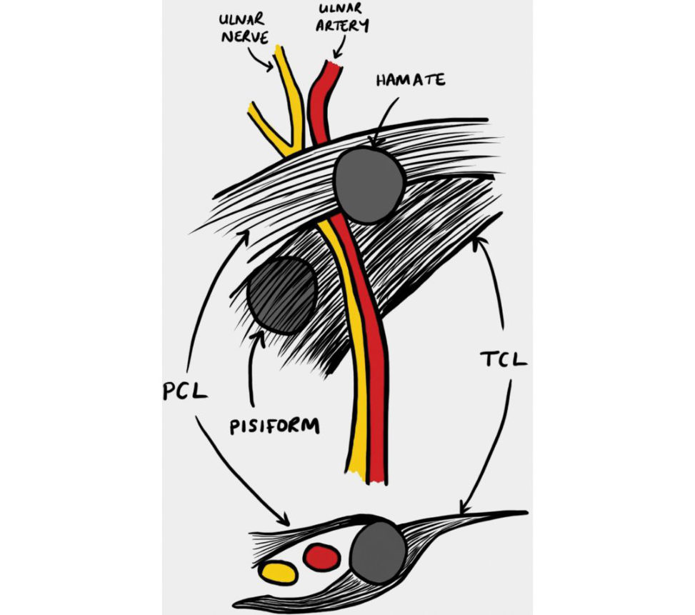 Figure 31.13