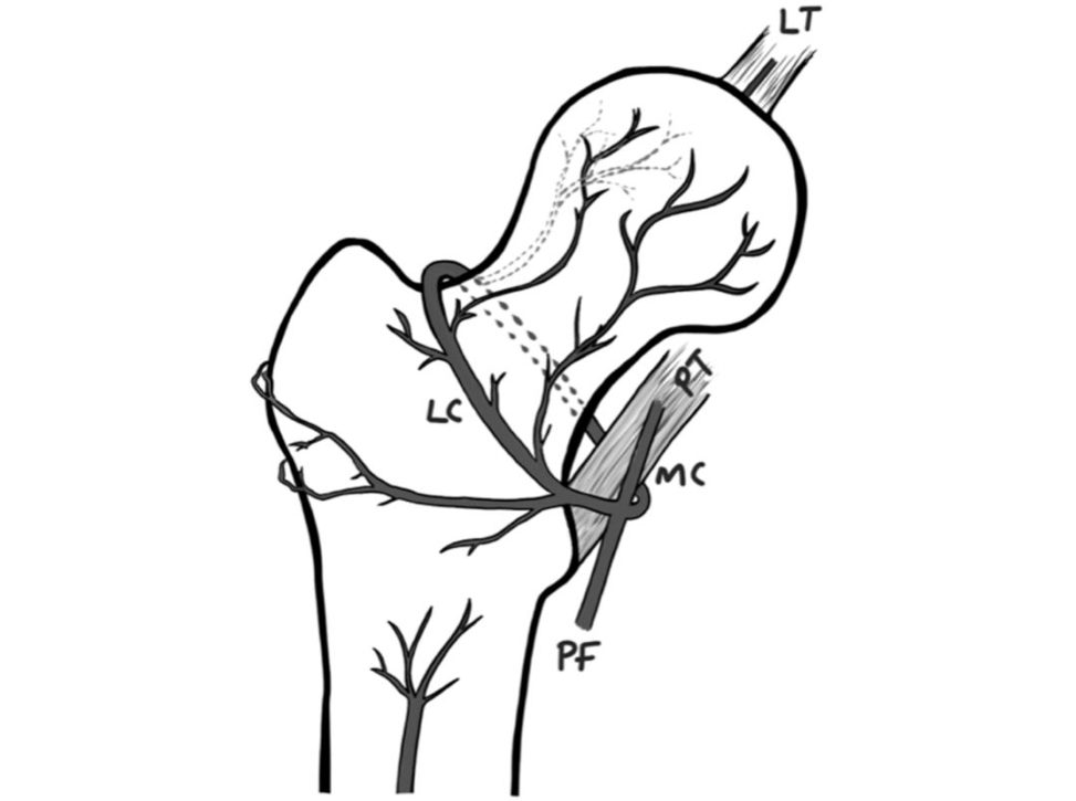Figure 31.17