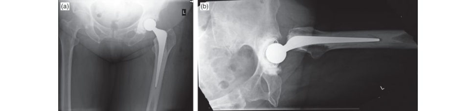 Figure 3.1a
