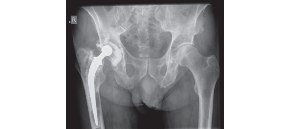 Figure 3.3a