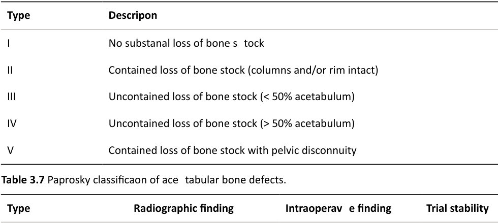 Table rendered from source