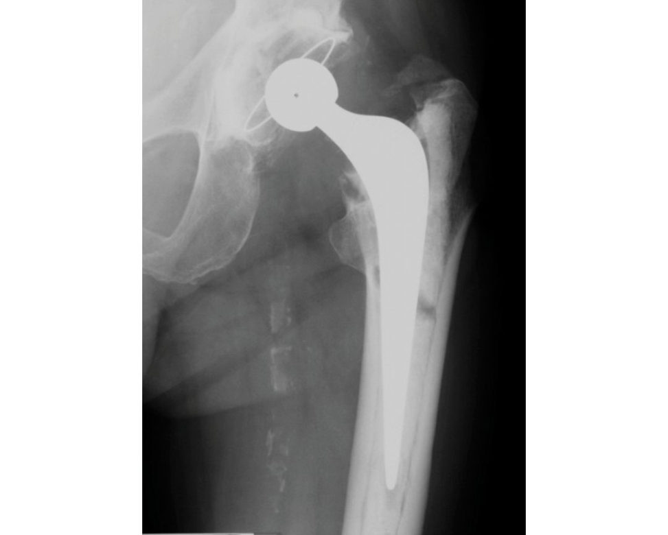 Figure 3.10