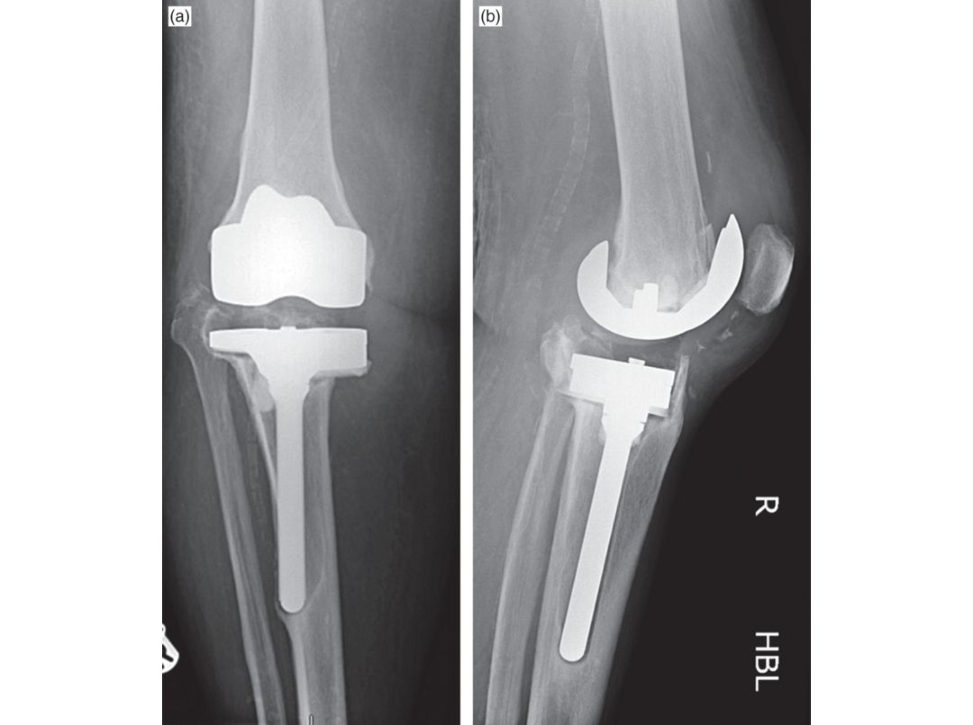 Figure 4.8a