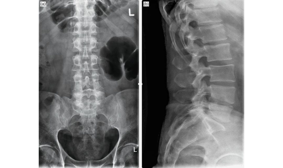 Figure 6.1a