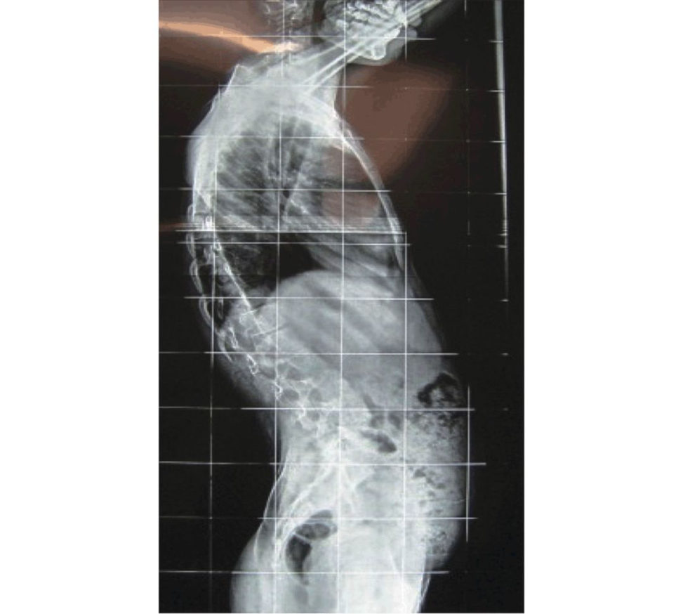 Figure 6.8b