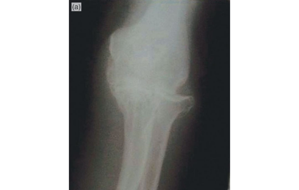 Figure 8.2a